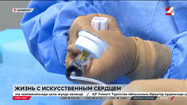 Как живут люди с искусственным сердцем