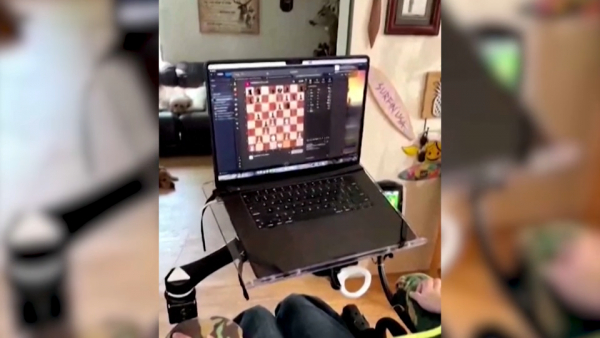 Первый пациент с мозговым имплантом сыграл в шахматы