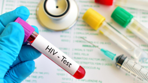 Ажар Гиният: ВИЧ остается актуальной проблемой