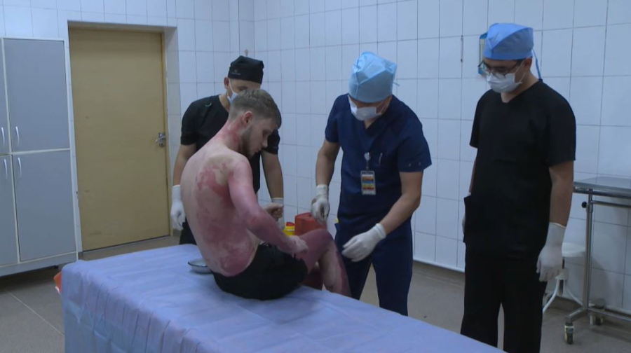 Пациента с ожогами 89% тела спасли врачи в Алматы