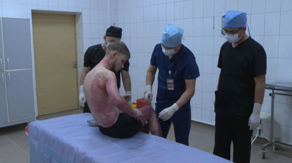 Пациента с ожогами 89% тела спасли врачи в Алматы