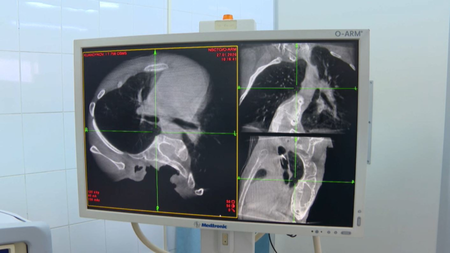 Тегін жасалатын күрделі операциялардың саны артты