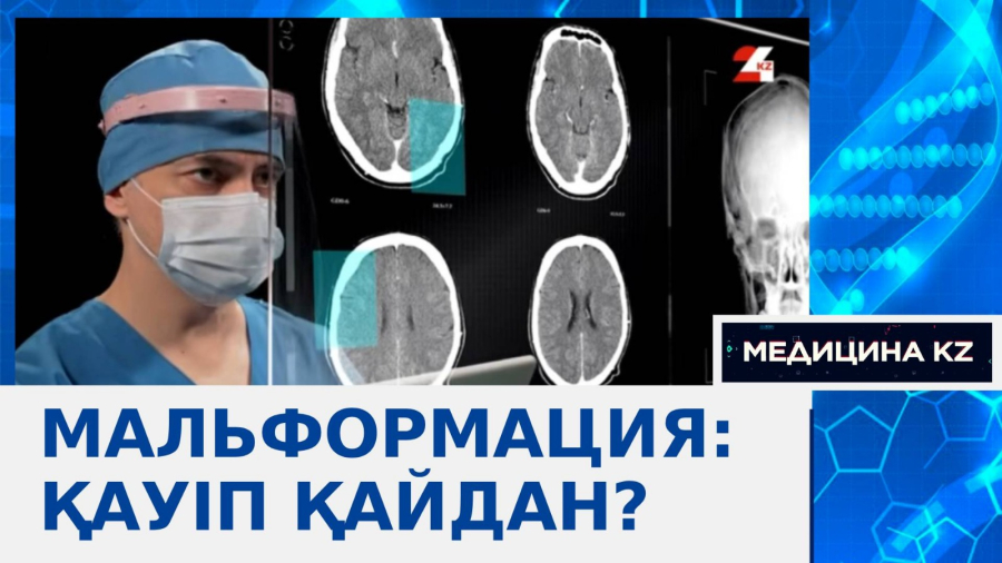 Мальформация: Қауіп қайдан?