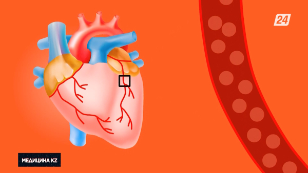 Жүрек ауруларының симптомдары мен оның алдын алу жолдары