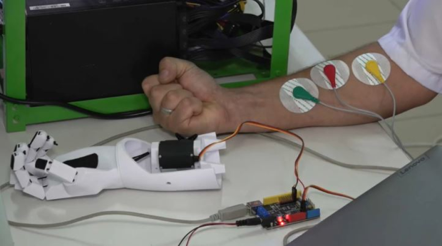 Искусственную руку создают в Уральске