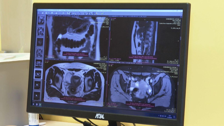 Қазақстанда 41 мың адамнан онкология ауруы анықталды