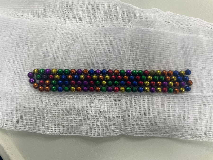 105 магнитных бусин извлекли из желудка 2-летнего ребенка в Алматы