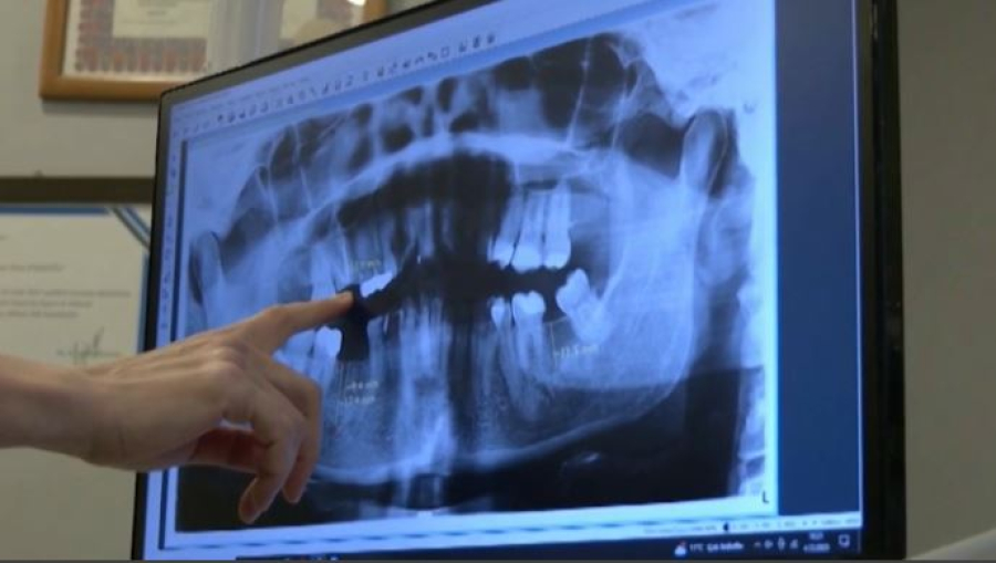 Әлемде тіс емдеу құны қанша тұрады?