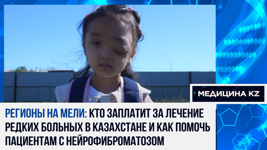 Проклятие генов: что такое нейрофиброматоз и как лечат болезнь в Казахстане