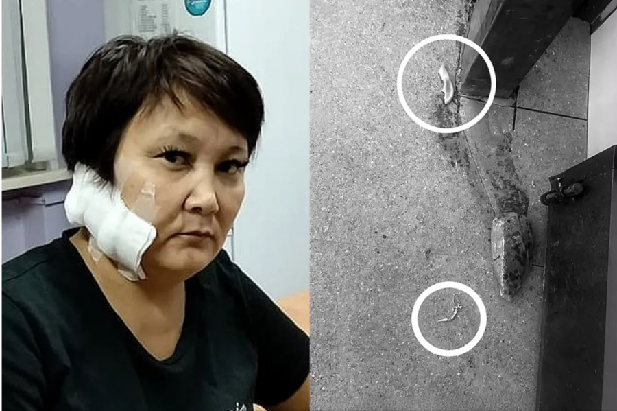 ШҚО-да бұрынғы күйеуі әйелінің құлағын кесіп тастады