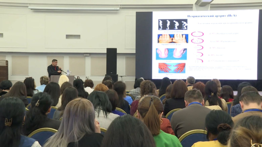 Қазақстанда миллионға жуық адам ревматологиялық ауруға шалдыққан