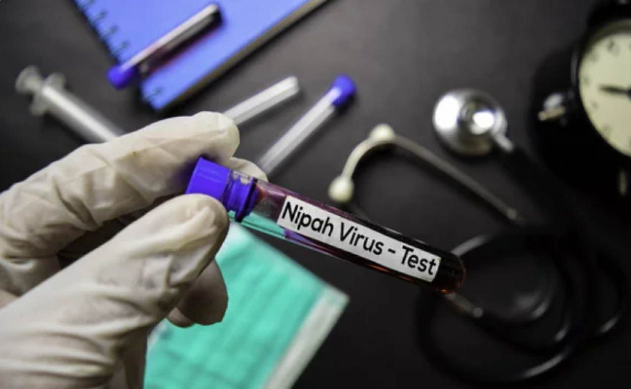 Случаи заражения вирусом Нипах не зарегистрированы в Казахстане
