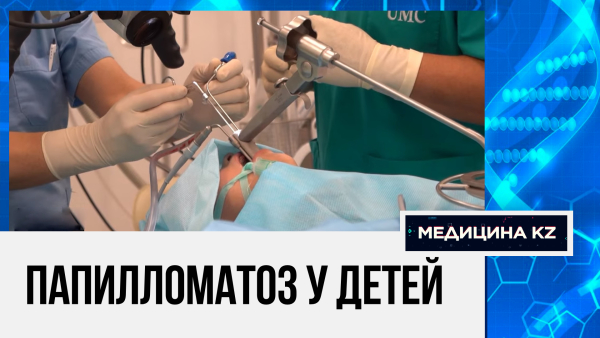 Переносят по 20 операций и больше: папилломатоз гортани и как его лечат в Казахстане