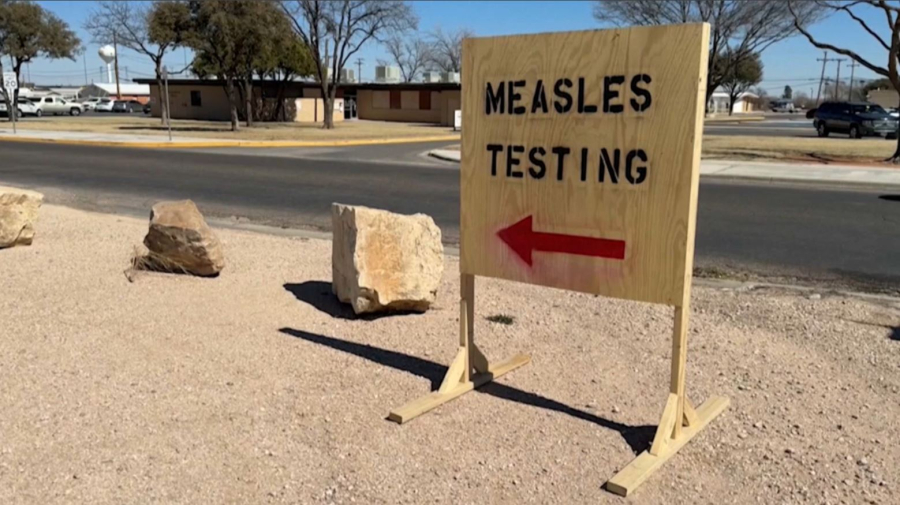 АҚШ, Канада және Мексикада қызылшаға шалдыққандар саны артты