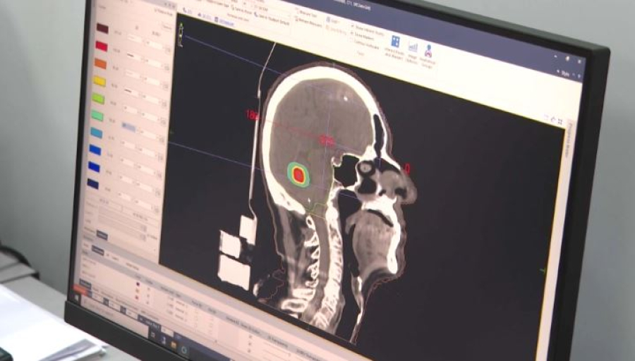 Жасанды интеллект дертті ерте анықтайды