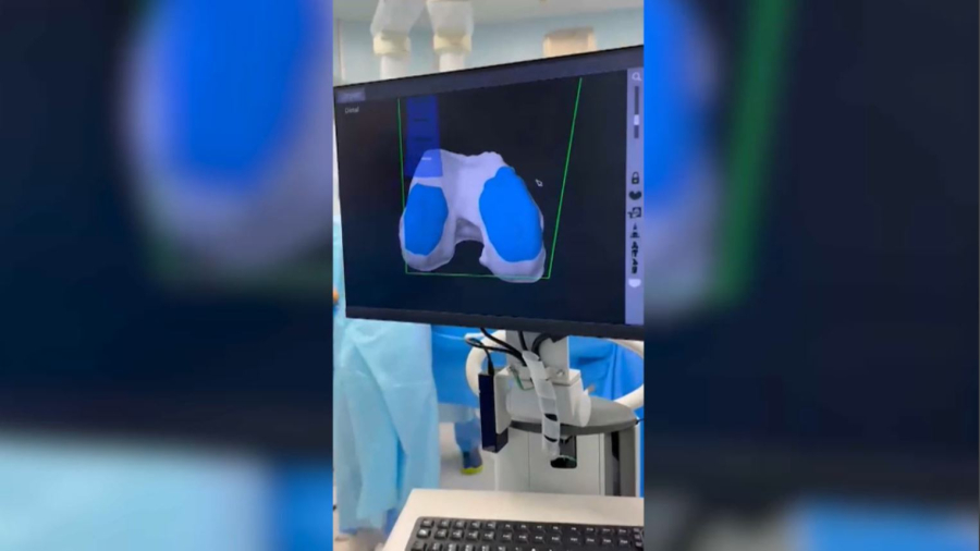 Елордада роботтың көмегімен 50 операция жасалды