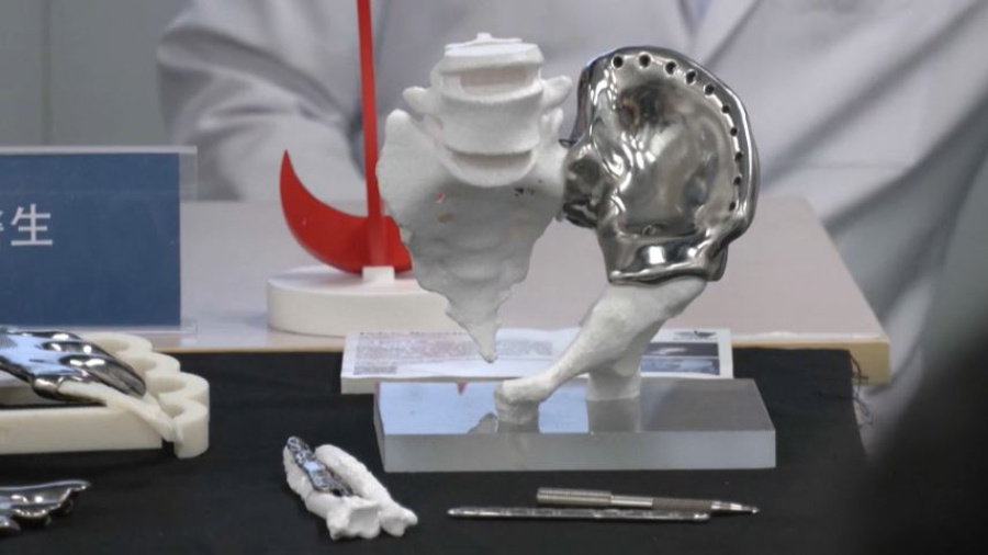 Жасанды интеллект сүйектің 3D үлгісін жасайды