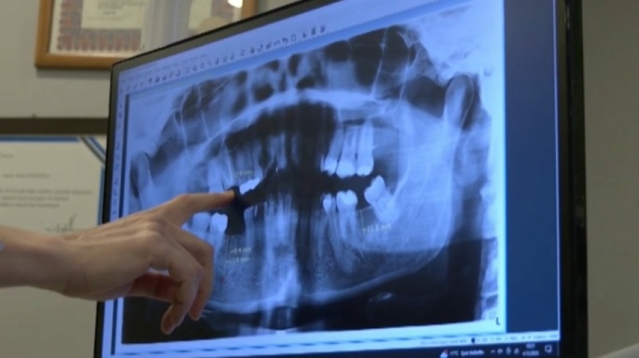 Стоматологическая помощь в США – самая дорогая в мире