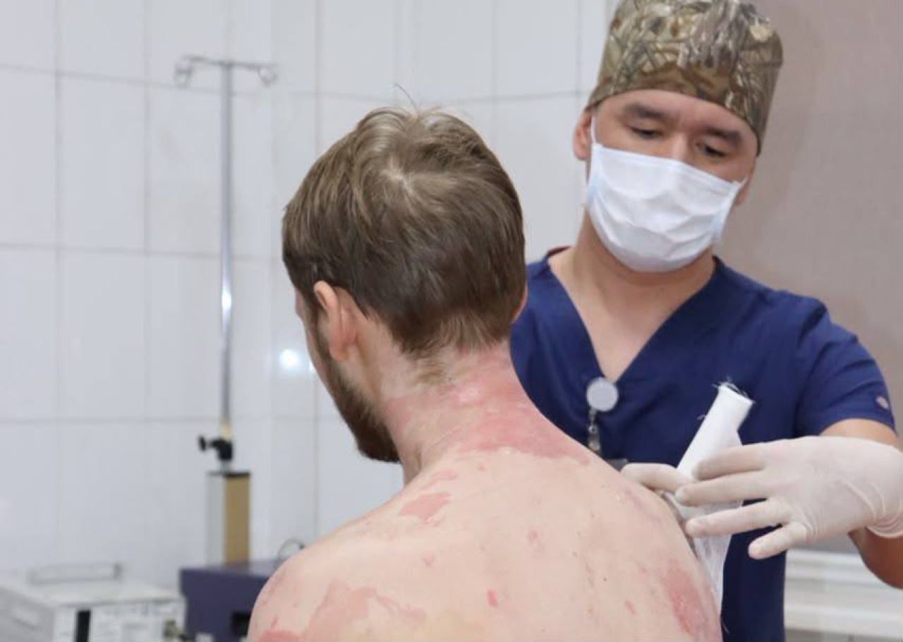 В Алматы врачи спасли мужчину с ожогами 89% тела после взрыва газового баллона