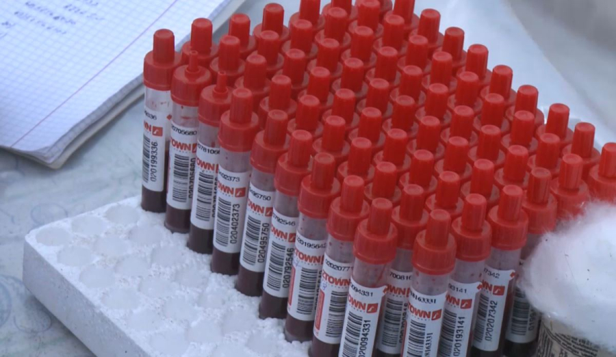 Қостанай облысында ірі қара малдан құтырма ауруы анықталды