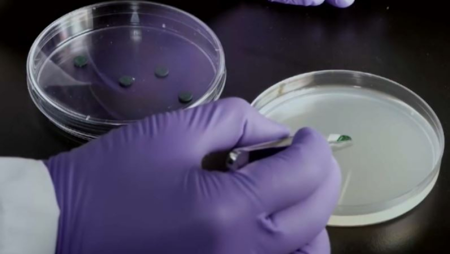 Супербактерии могут убить миллионы людей к 2050 году