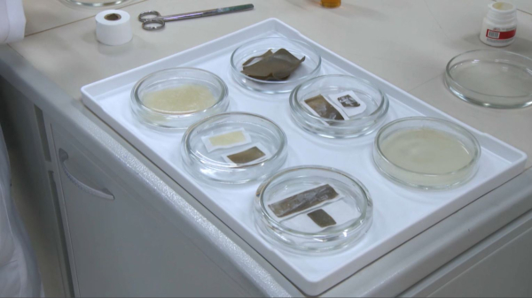 Заживляющий пластырь из природных материалов разработали алматинские учёные