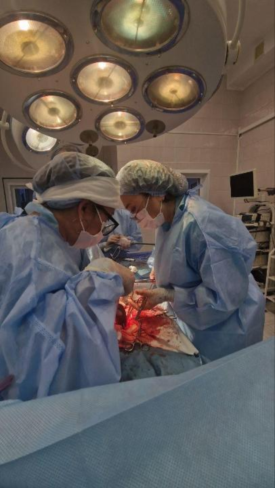 Жительнице Павлодара удалили гигантскую кисту