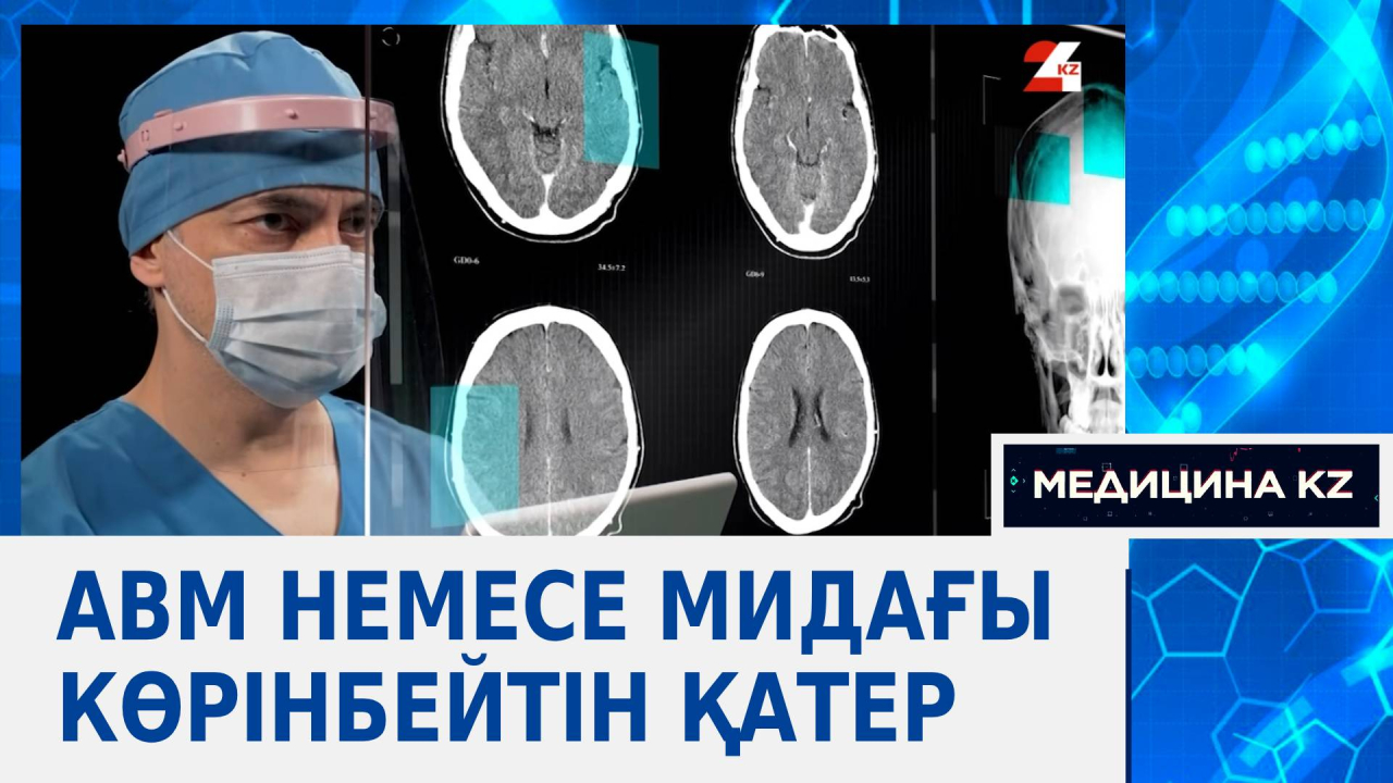 АВМ немесе мидағы көрінбейтін қатер