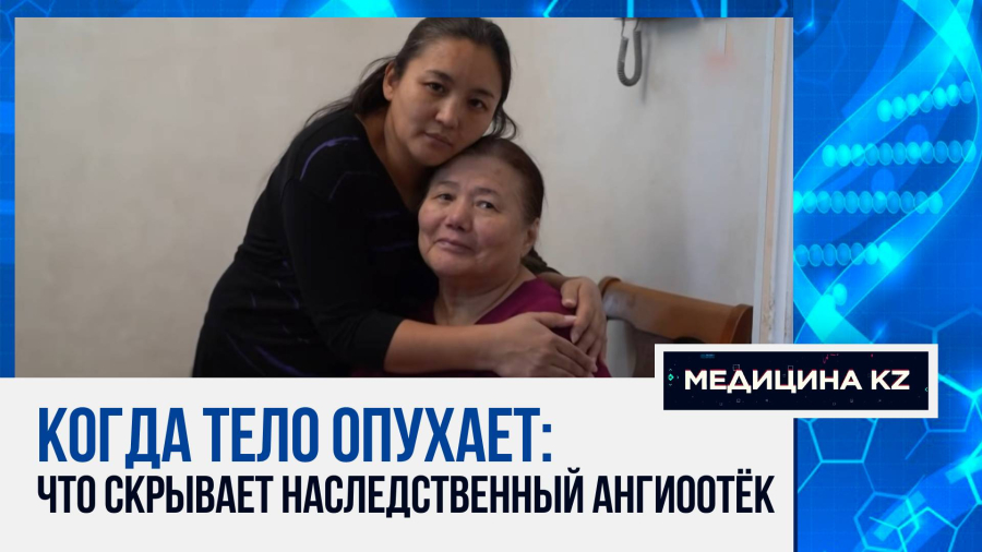 Страх смерти каждый день: как живут в Казахстане люди с редким диагнозом - НАО?