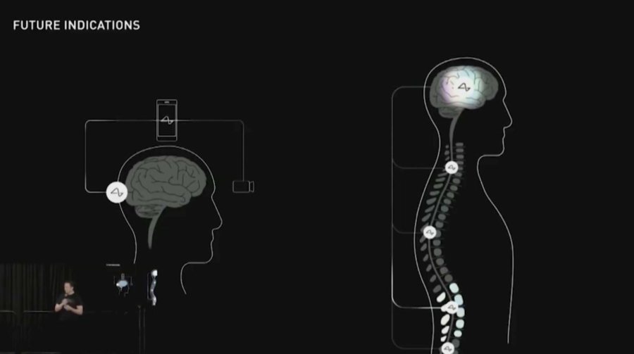 Neuralink планирует ежегодно вживлять до 20 тысяч чипов добровольцам