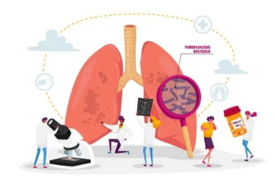 Свыше 4 тысяч случаев туберкулёза выявлено в Казахстане