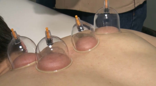 Хиджаманы кез келген жерде жасатуға болмайды