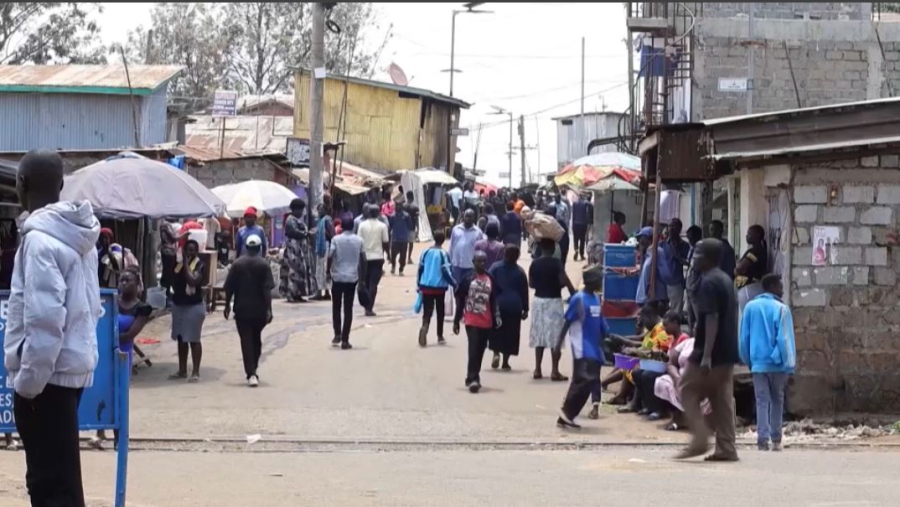 Әлемде жылына 7 мың бүйрек сатылады