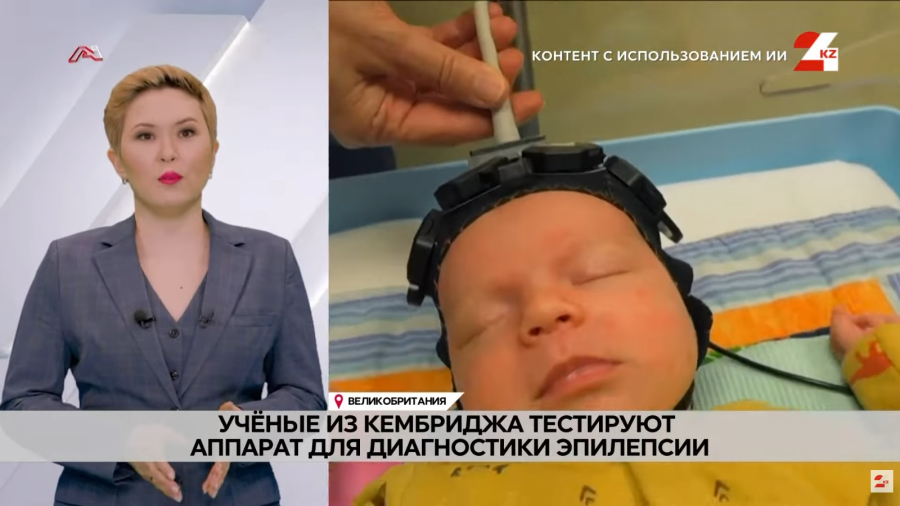 Учёные из Кембриджа тестируют аппарат для диагностики эпилепсии