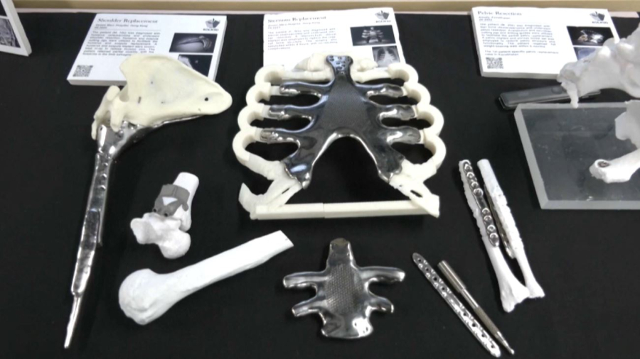 ИИ-технология создаёт 3D-кости по рентгену