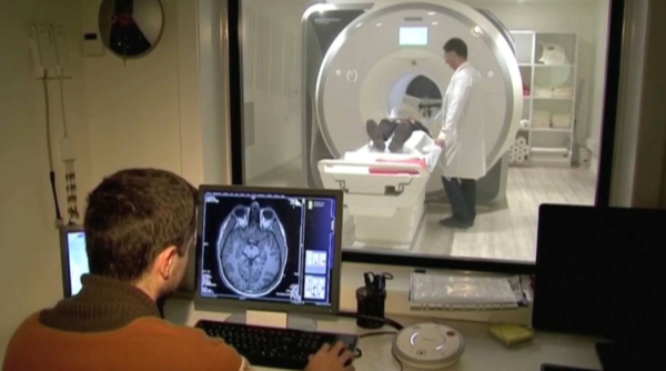 ИИ для ранней диагностики эпилепсии используют учёные из Лондона