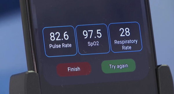 Қан қысымын өлшейтін жасанды интеллект