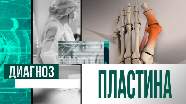 Кеуде қуысының деформациясы, буын алмастыру | Диагноз