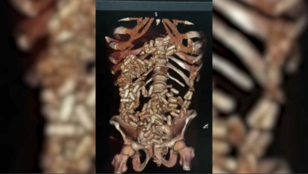 Два килограмма наркотиков пытались провезти в желудке иностранцы в Актау