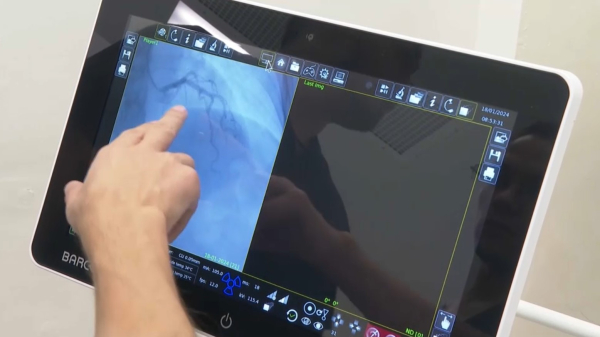 Инновационные методы лечения осваивают хирурги-кардиологи Туркестанской области