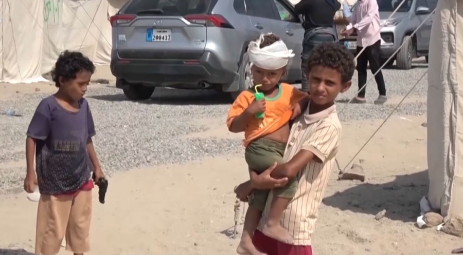 Йеменде балалар арасында аштық күшейді