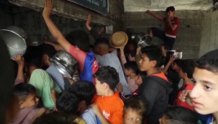 Голод в Газе: 350 детей госпитализируют ежедневно