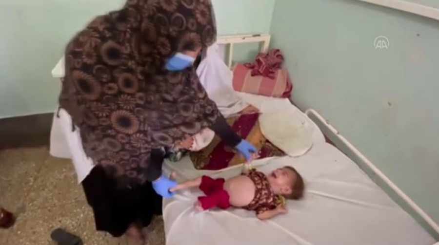 ООН: 3,5 млн детей страдают от недоедания в Афганистане