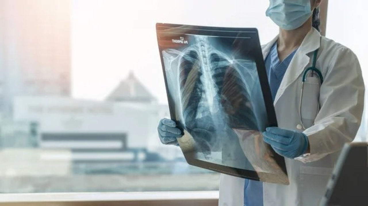 Қазақстанда туберкулезден болатын өлім-жітім 25%-ға азайды