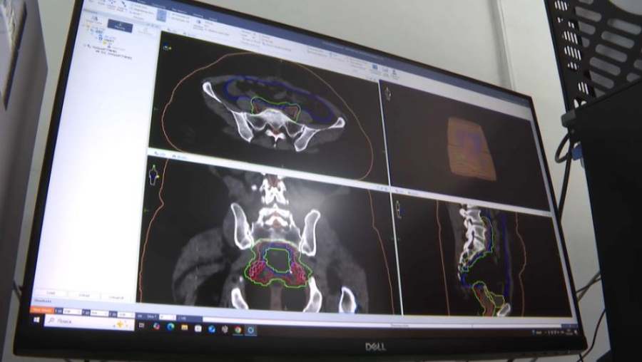 ЖИ емдеу ісінде қолданылады