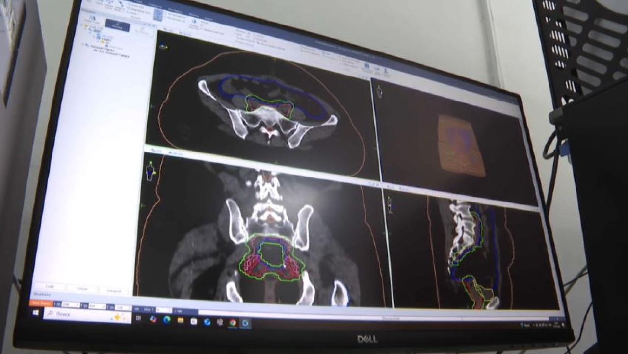 ЖИ емдеу ісінде қолданылады